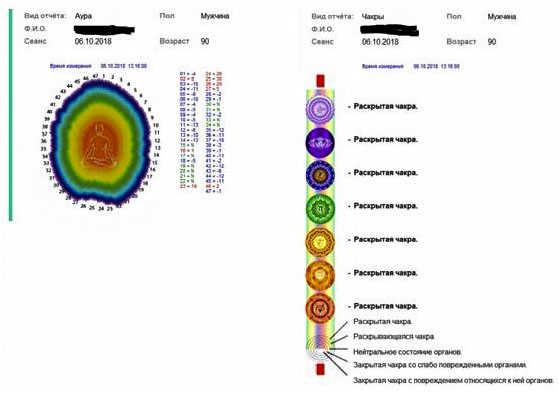 Снимок компьютерной диагностики после четырёх месяцев приёма гидроплазмы Инюшина.